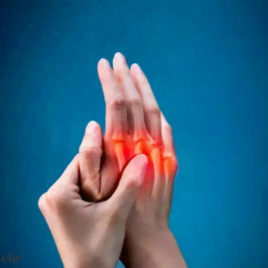 Rheumatoid arthritis