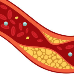 Cholesterol